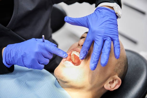 Best Emergency Broken Tooth Repair in Gilcrest, CO
